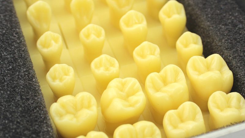补牙材料与根管治疗材料：如何选择更适合你的方案